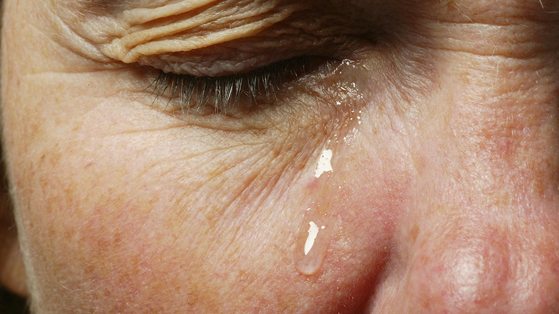 Por que os olhos de algumas pessoas lacrimejam tanto? Conheça motivos -  25/01/2021 - UOL VivaBem